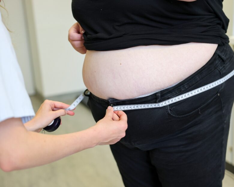 Παχυσαρκία