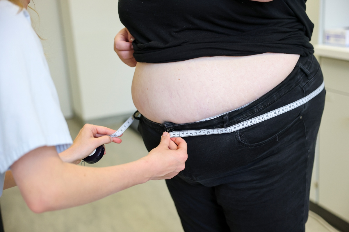 Παχυσαρκία