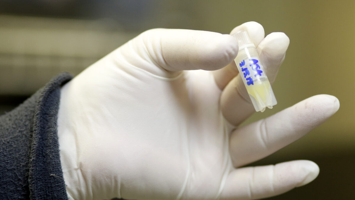 Κατεψυγμένο σπέρμα