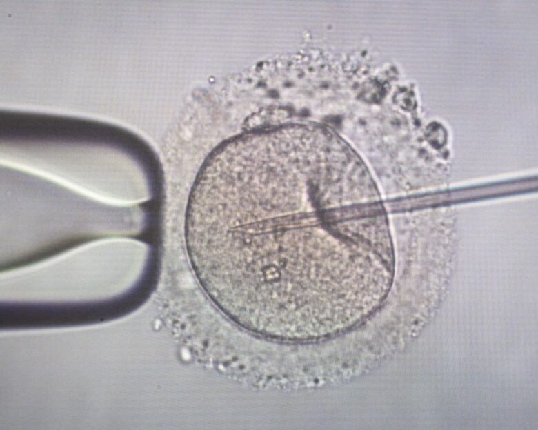 Σπέρμα με καρκινικό γονίδιο: Δότης έγινε πατέρας τουλάχιστον 197 παιδιών στην Ευρώπη, μεταξύ άλλων και στην Ελλάδα – Κάποια πέθαναν