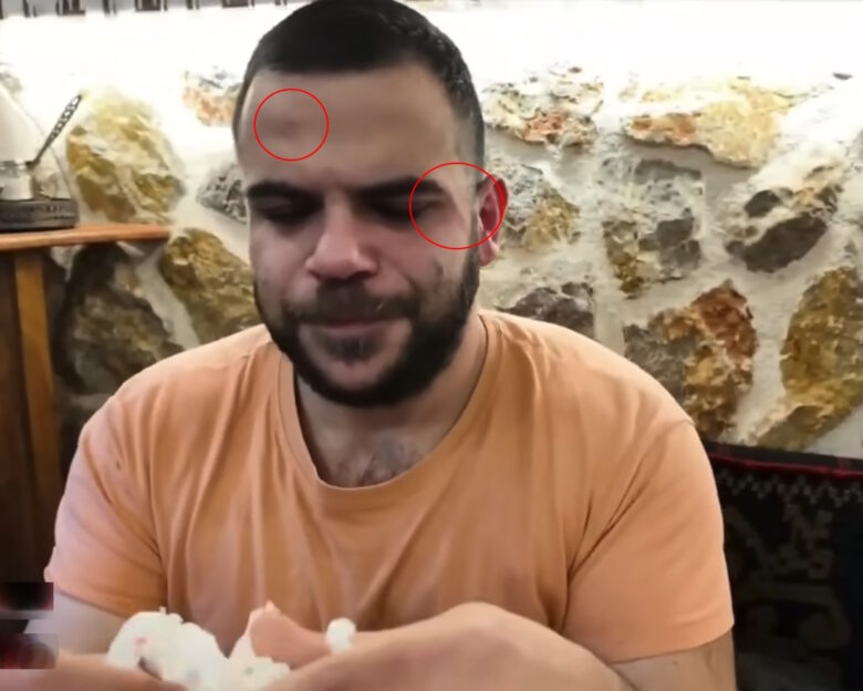 Ο γνωστός Youtuber Teosty έπεσε ξανά θύμα ξυλοδαρμού σε live μετάδοση