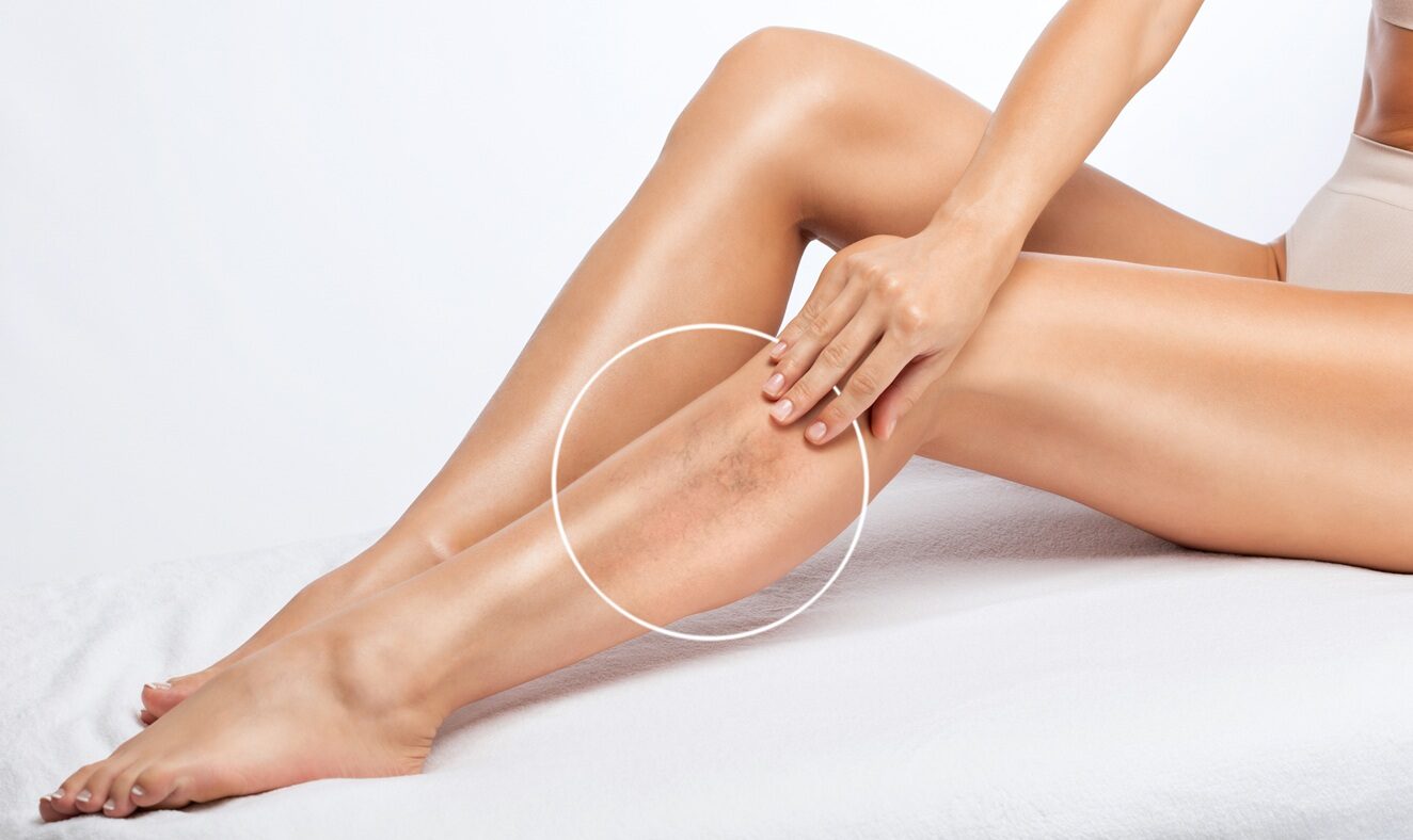 Πηγή φωτό: iStock