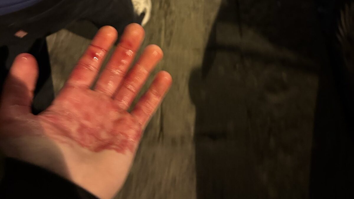 Μαχαίρωσαν δύο οπαδούς της Τσέλσι πριν το παιχνίδι με τη Νάπολι