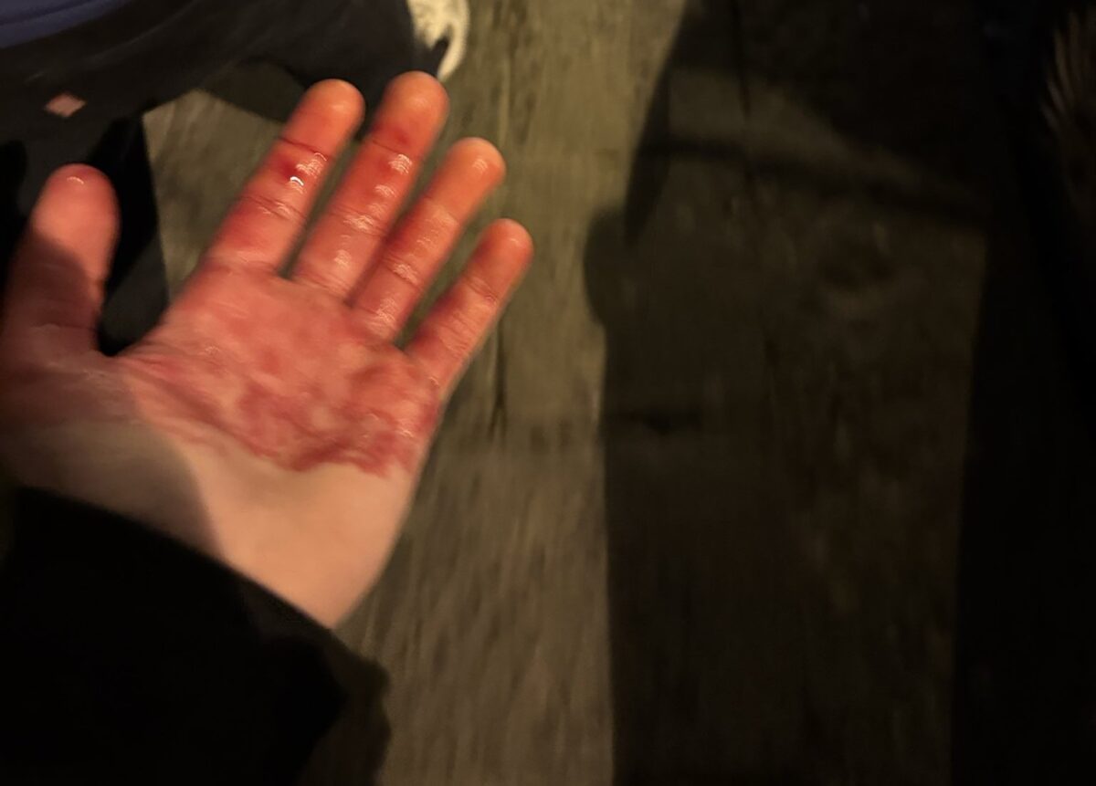 Μαχαίρωσαν δύο οπαδούς της Τσέλσι πριν το παιχνίδι με τη Νάπολι