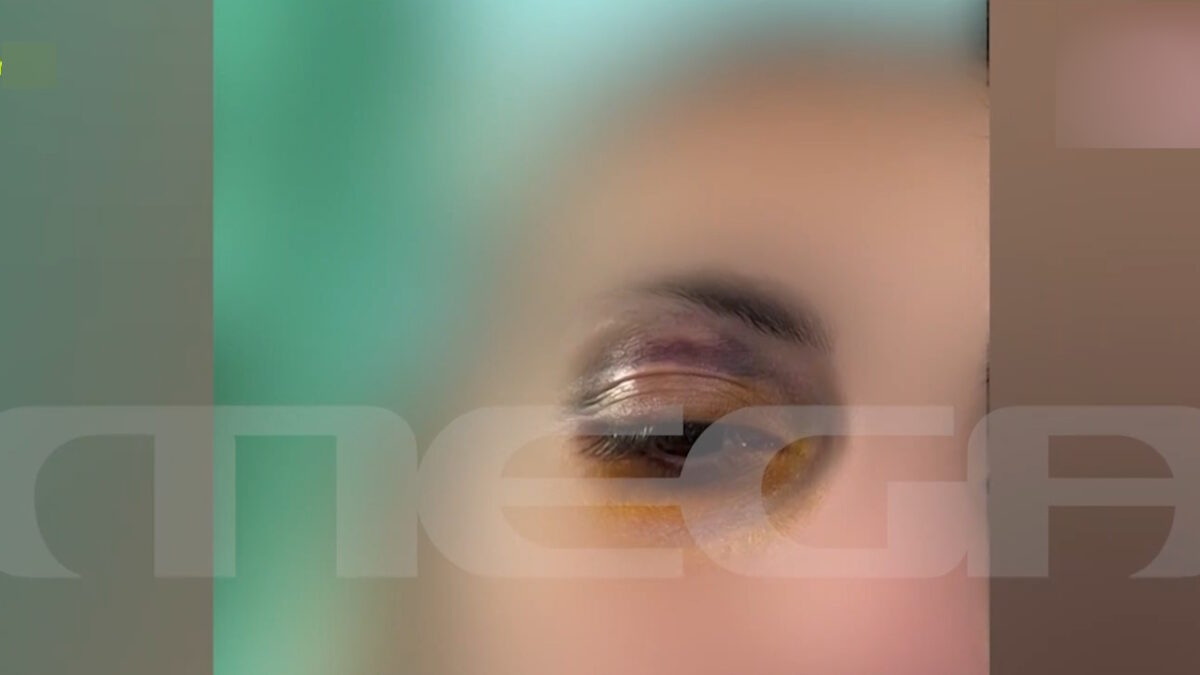 Ξυλοδαρμός