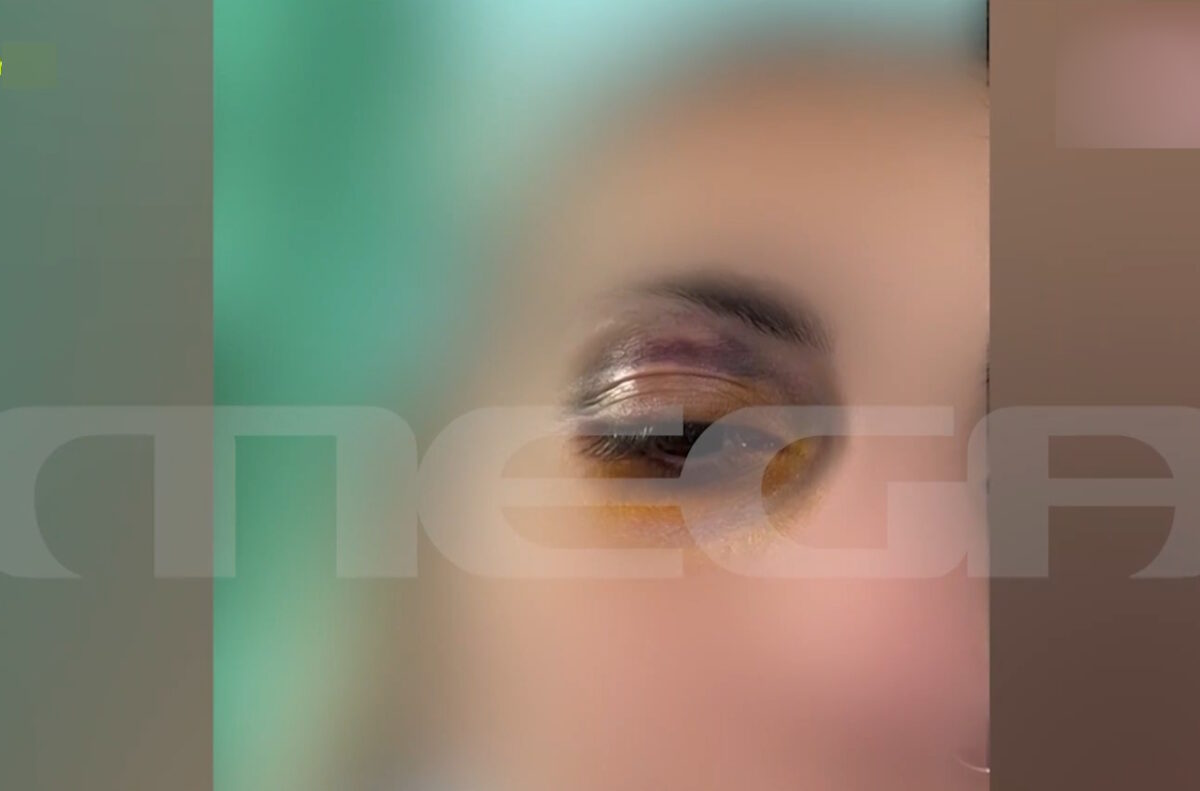 Ξυλοδαρμός