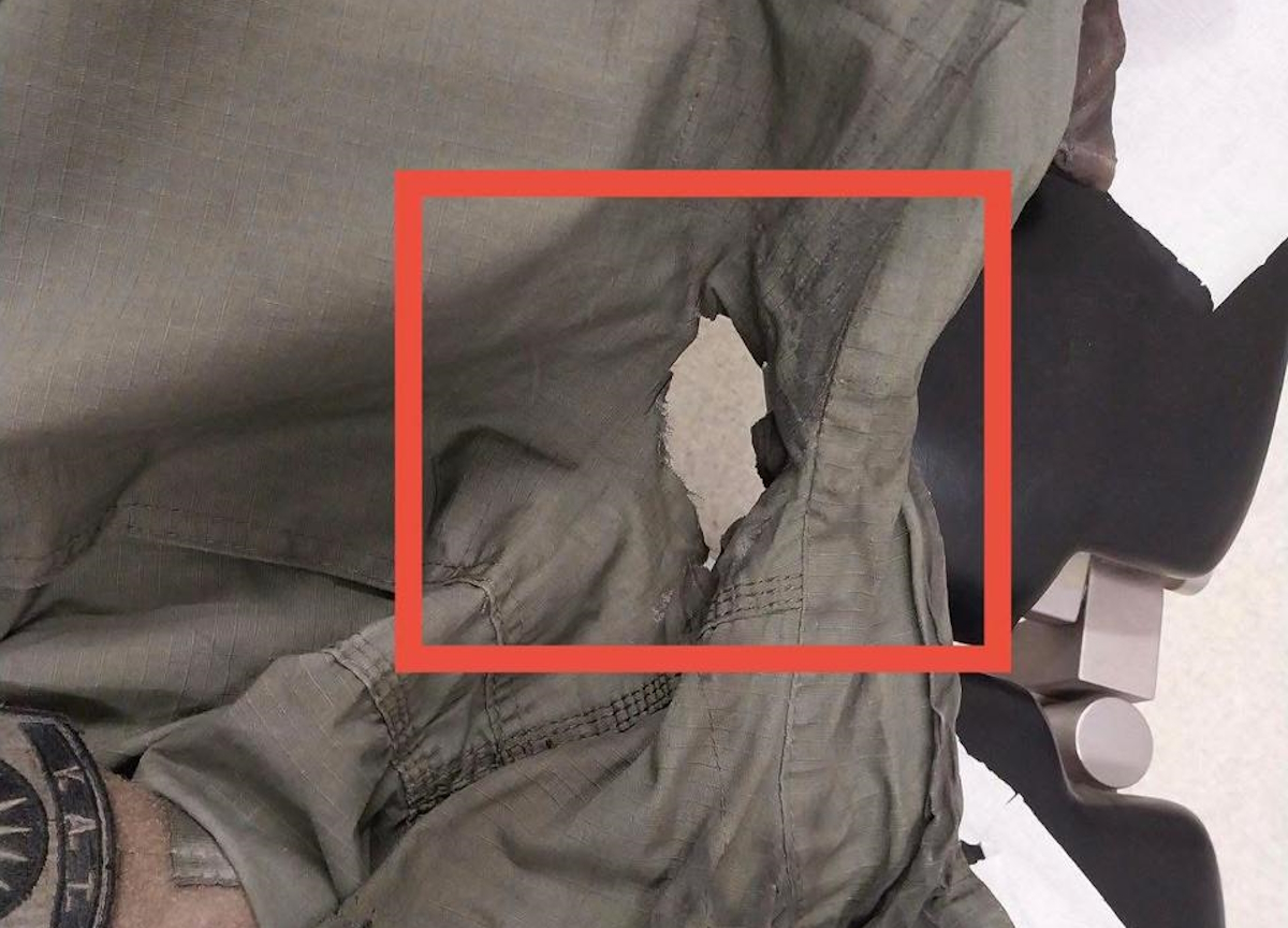 Η στολή του αστυνομικού που δέχθηκε τη βόμβα μολότοφ με αποτέλεσμα ο άνδρας της ΕΛΑΣ να υποστεί εγκαύματα σε πρόσωπο και αυχένα