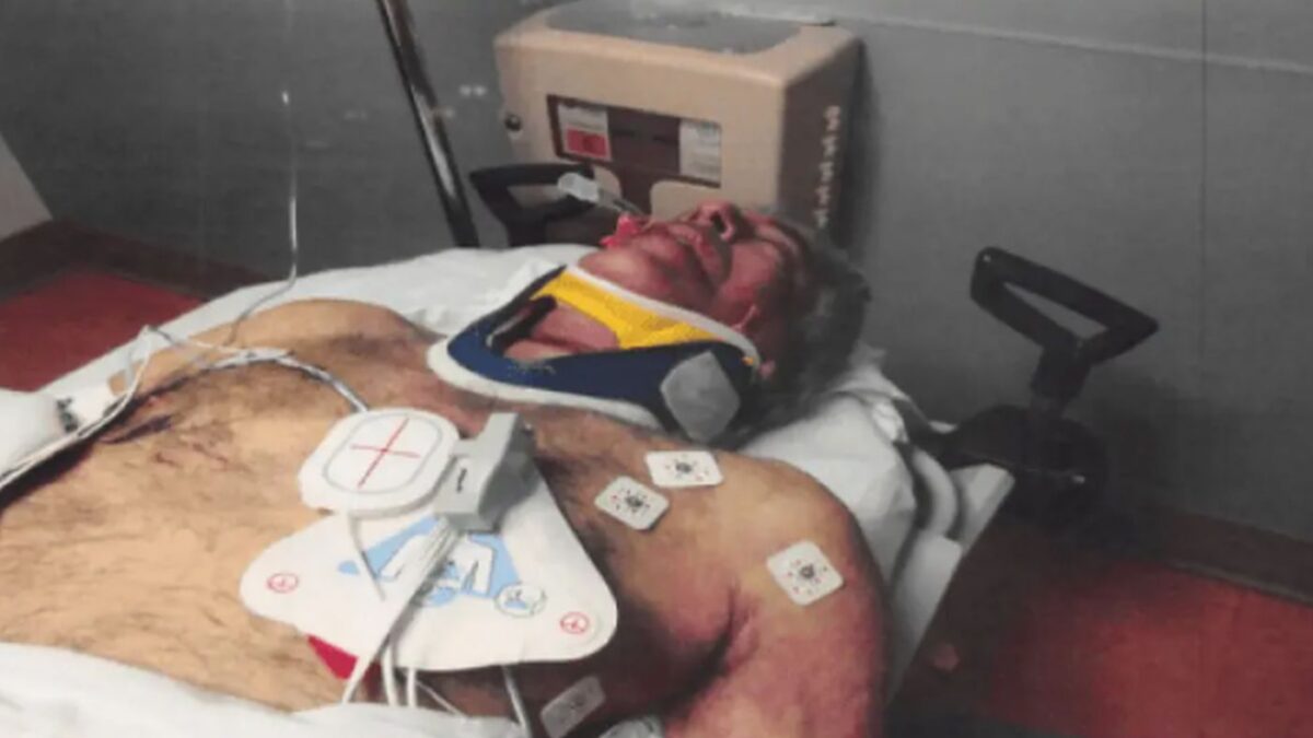 Το πρησμένο πρόσωπό του Επστάιν