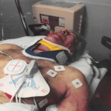 Το πρησμένο πρόσωπό του Επστάιν