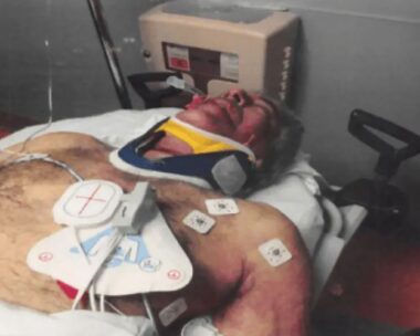 Το πρησμένο πρόσωπό του Επστάιν