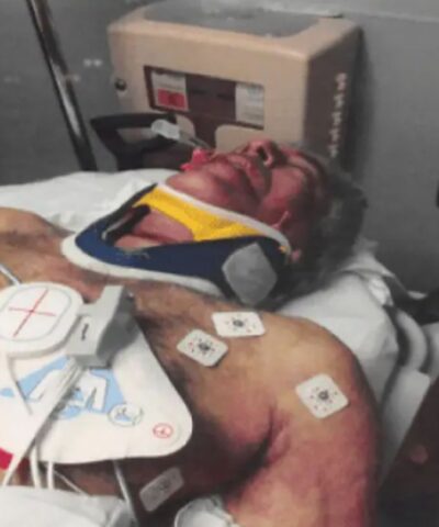 Το πρησμένο πρόσωπό του Επστάιν