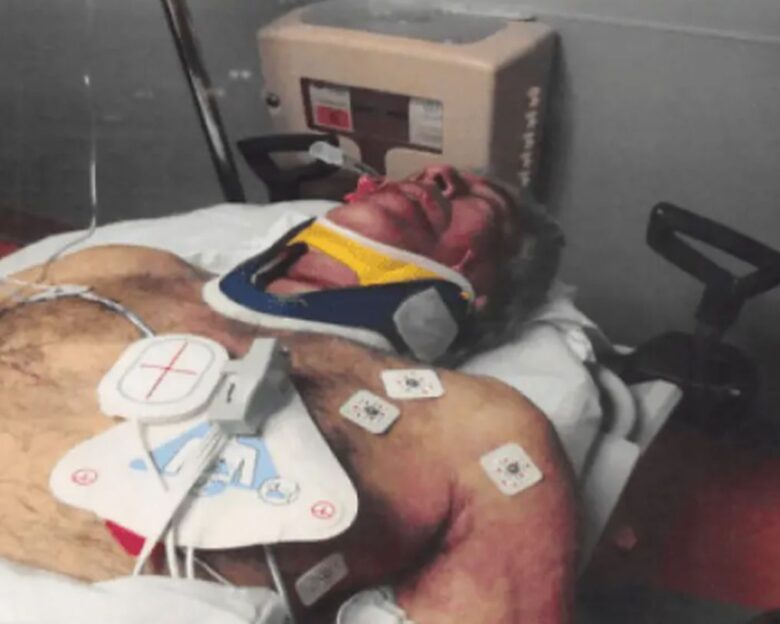 Το πρησμένο πρόσωπό του Επστάιν