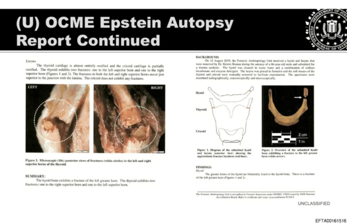 Φωτογραφίες του θυρεοειδούς χόνδρου του Επστάιν που σχεδόν έσπασε