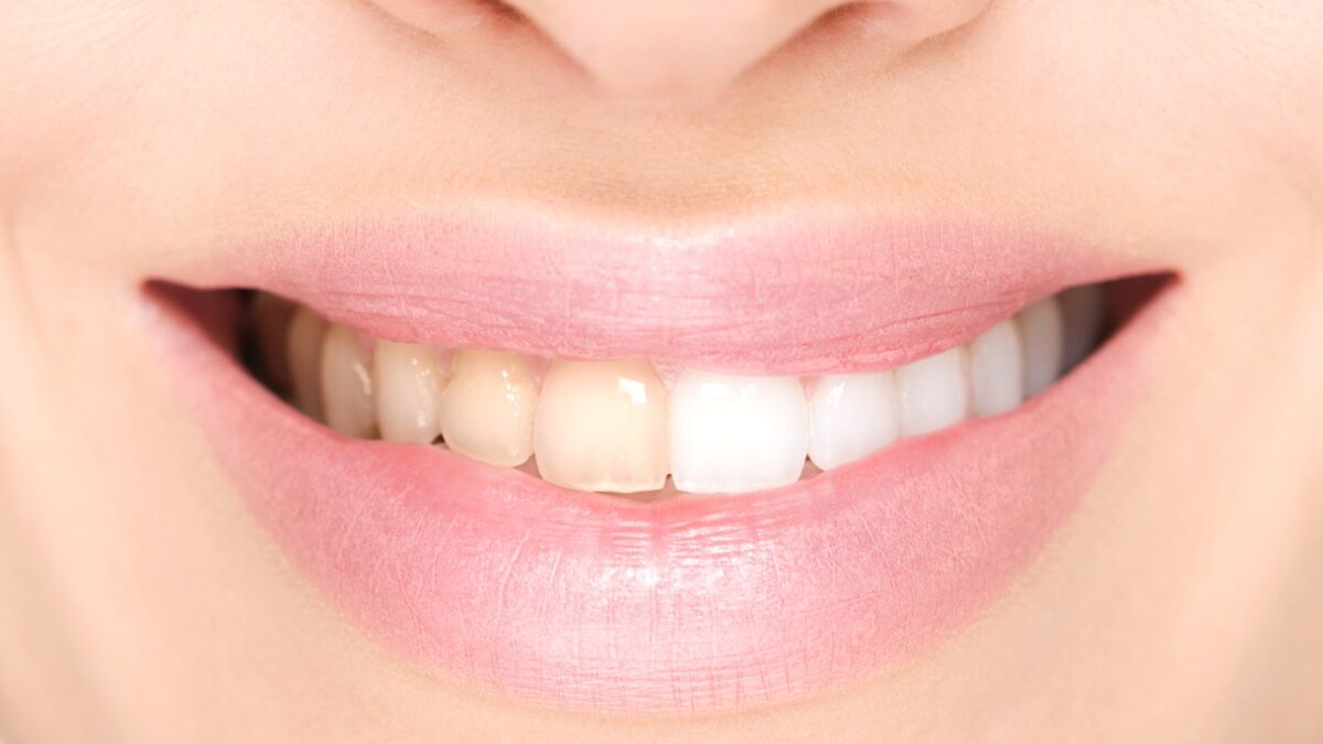 Πηγή φωτό: iStock