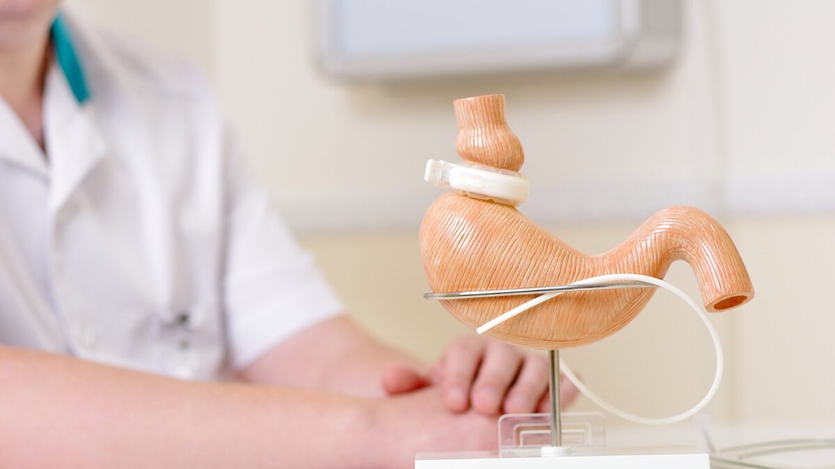 Γαστρικός δακτύλιος