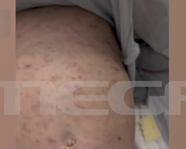 Το βρέφος με μηνιγγίτιδα