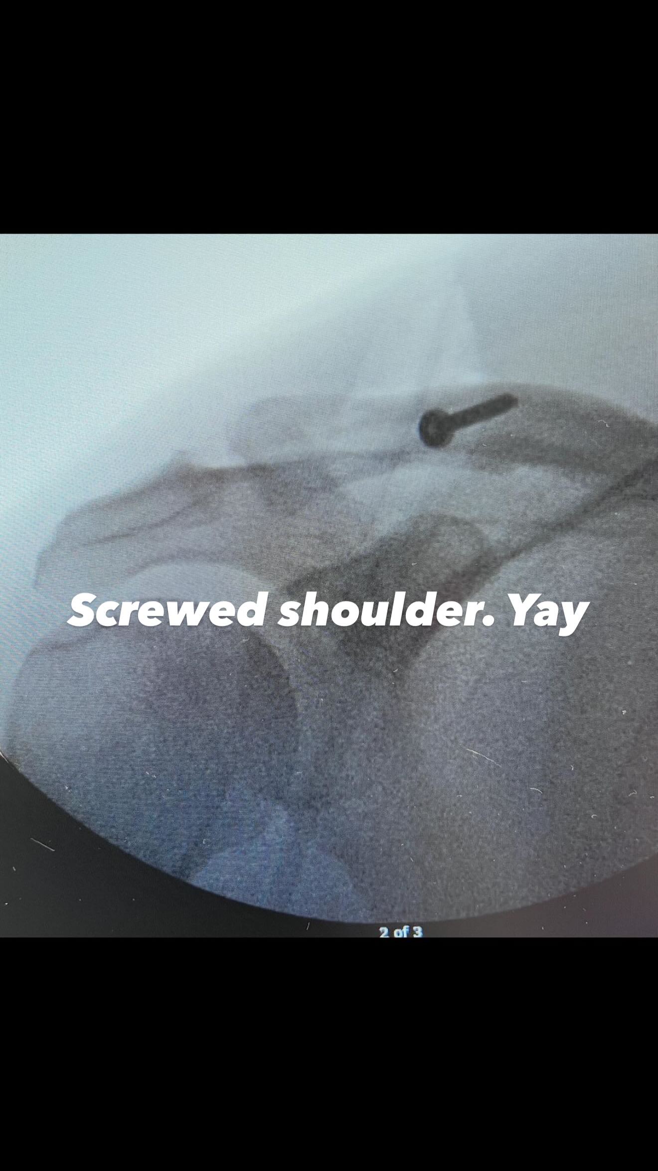 Η φωτογραφία μετά την επέμβαση