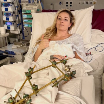 Η Λίντσεϊ Βον