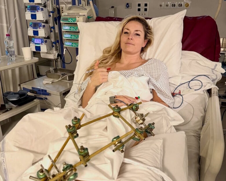 Η Λίντσεϊ Βον