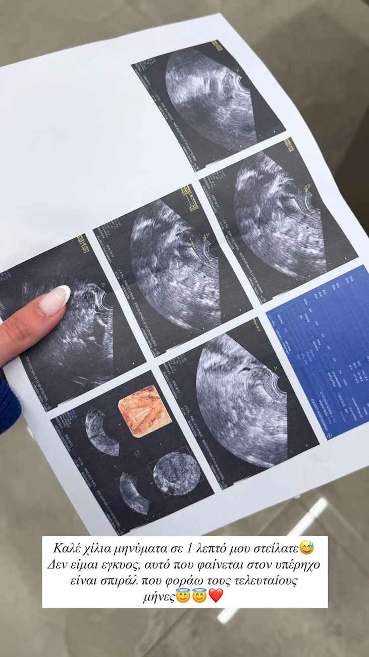 Η ανάρτηση της Ιωάννας Τούνη