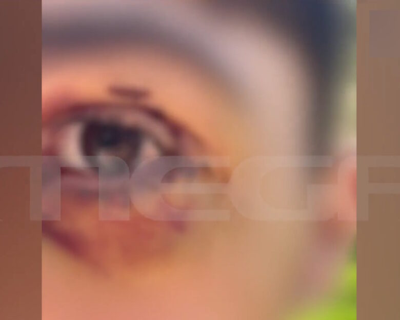 16χρονος στα Γιάννενα