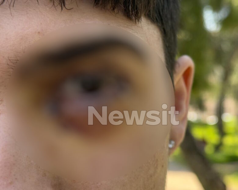 16χρονος στα Ιωάννινα