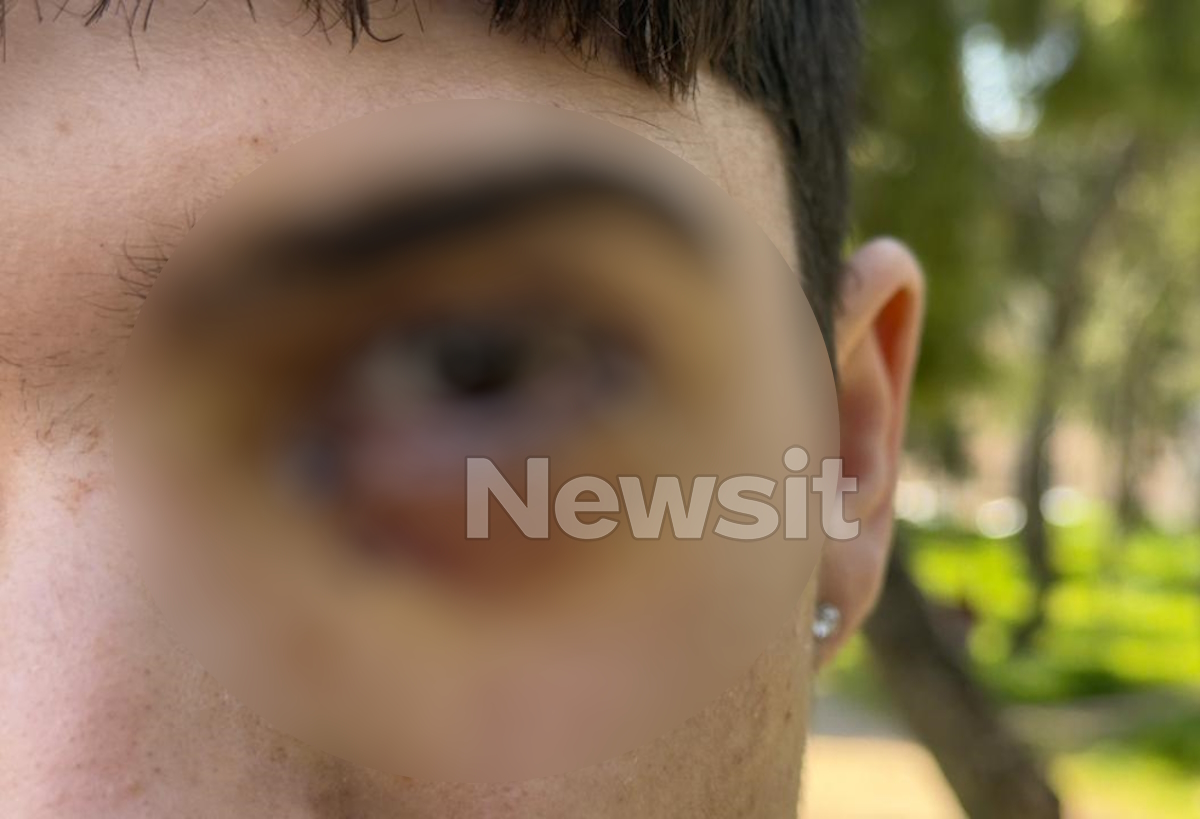 16χρονος στα Ιωάννινα