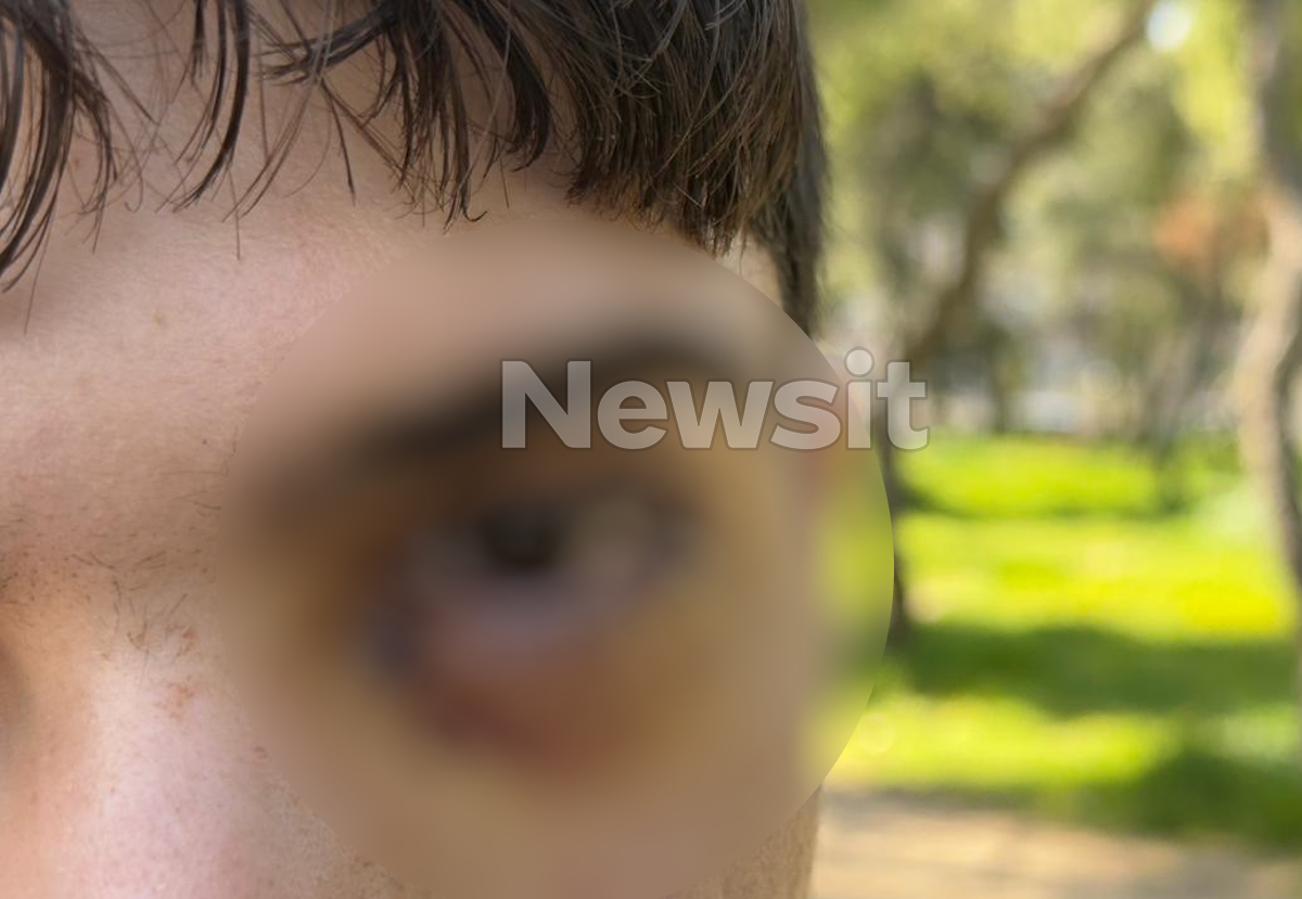 16χρονος στα Ιωάννινα