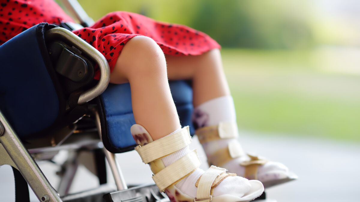 Disabled girl sitting in wheelchair. On her legs orthopedic equipment . Child cerebral palsy. Inclusion. Family with disabled kid.