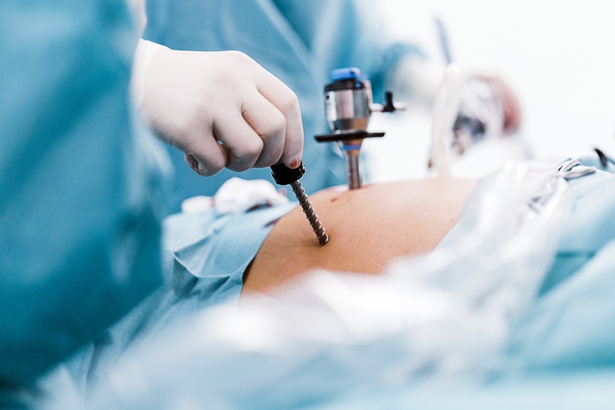 Παχυσαρκία: Η χειρουργική αντιμετώπιση αποδεικνύεται πιο αποτελεσματική από τα φάρμακα