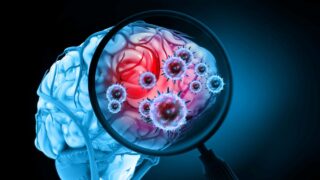 Μηνιγγίτιδα