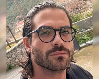 Ο μουσικός Άρης Μουγκοπέτρος που τραυματίστηκε σοβαρά από κροτίδα