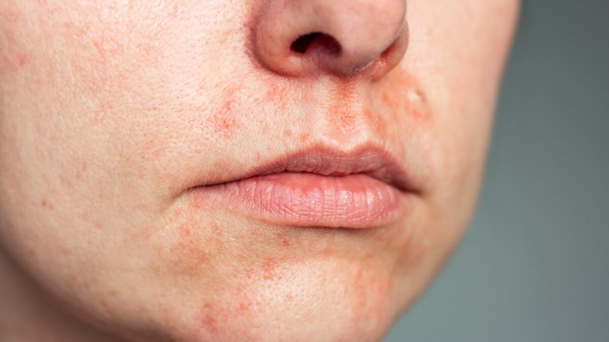 Πηγή φωτό: iStock