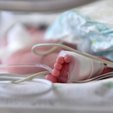 Newborn baby with cannula in the feet on a hospital bed