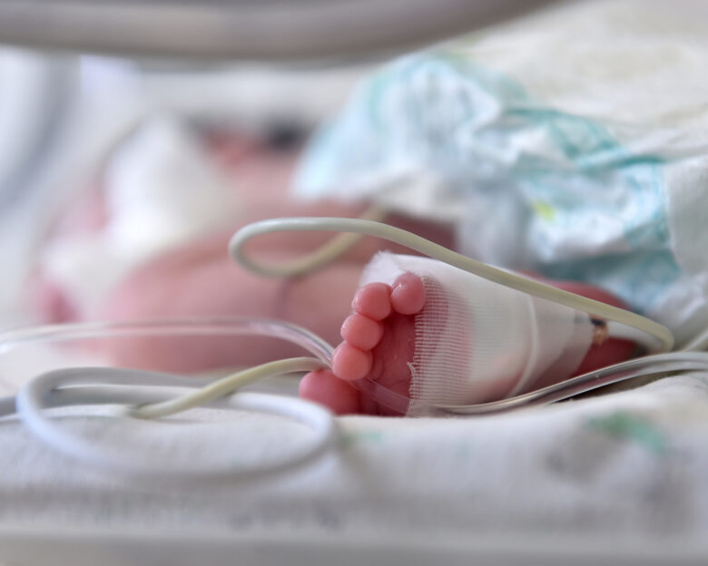 Newborn baby with cannula in the feet on a hospital bed
