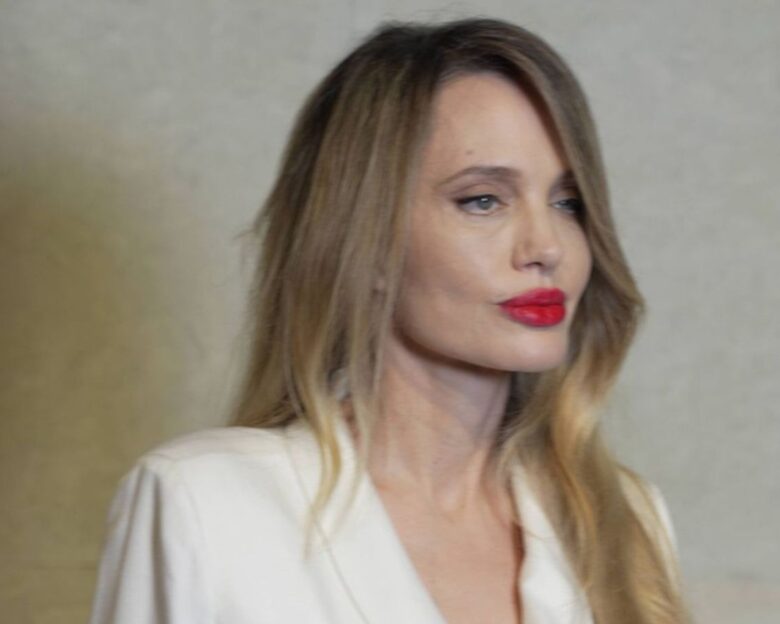 Η Αντζελίνα Τζολί