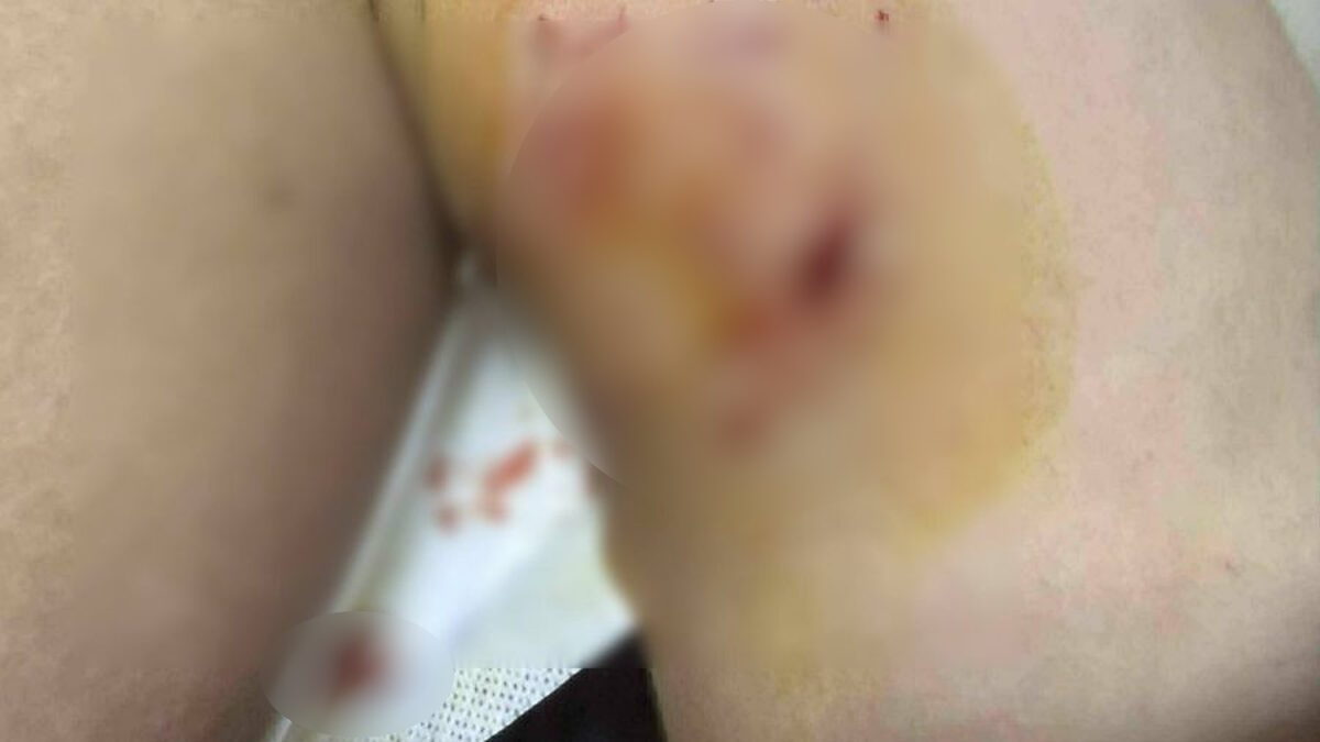 τραυμα 12χρονου