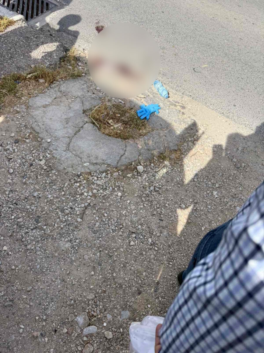 Το σημείο του τραυματισμού του 12χρονου