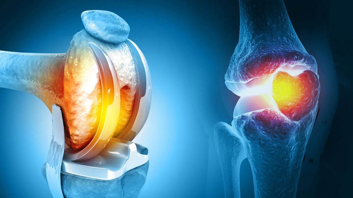 Πηγή φωτό: iStock