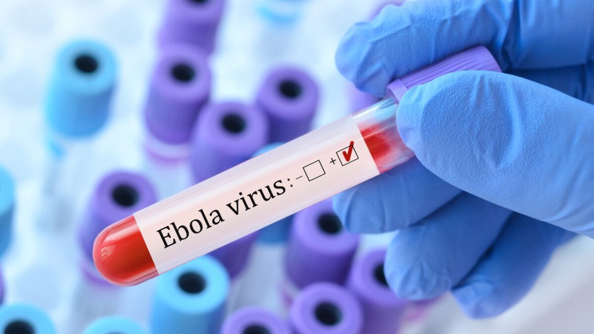 Doctor holding a test blood sample tube with Ebola virus test on the background of medical test tubes with analyzes.