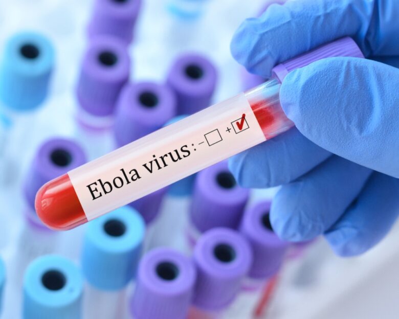 Doctor holding a test blood sample tube with Ebola virus test on the background of medical test tubes with analyzes.