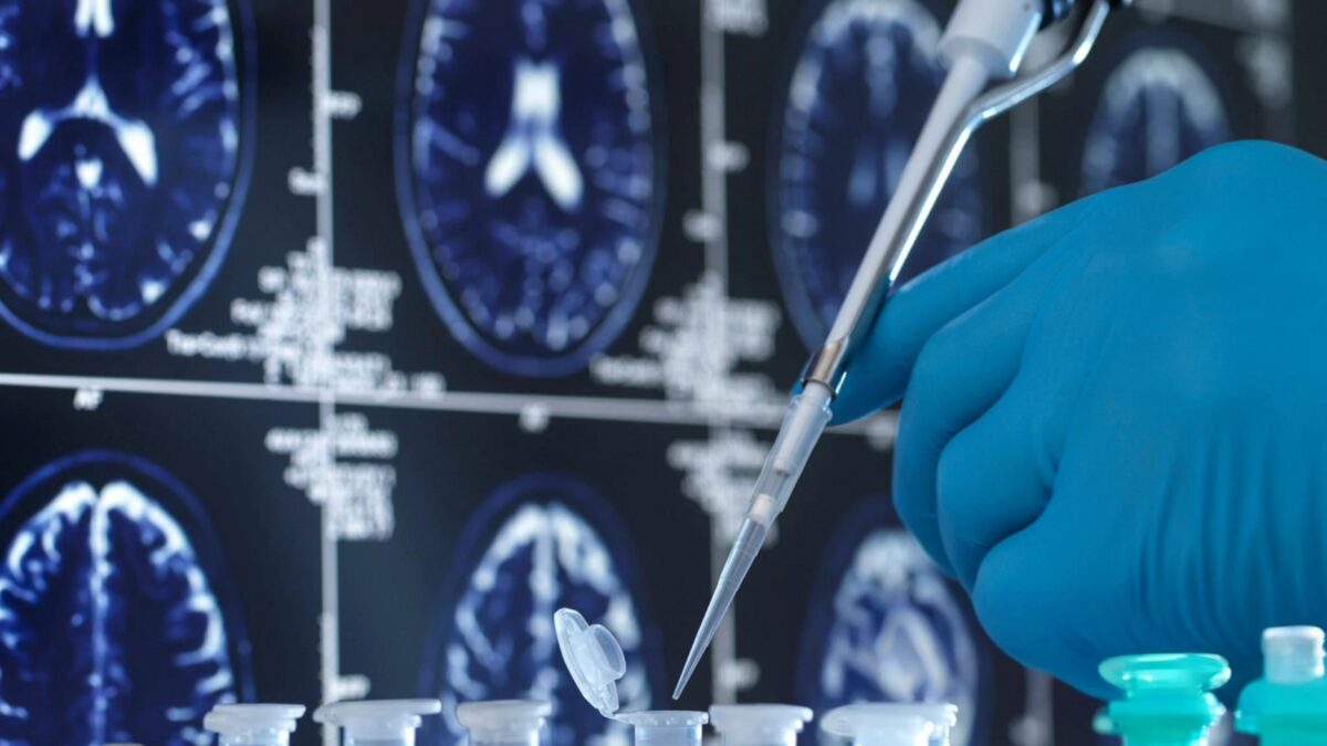A gloved hand holds a vial while a pipette dispenses a liquid, with brain scan images in the background.