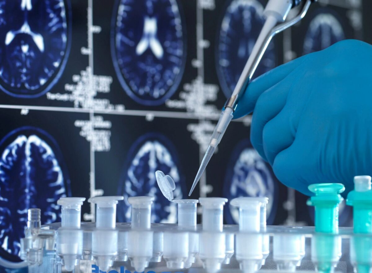 A gloved hand holds a vial while a pipette dispenses a liquid, with brain scan images in the background.