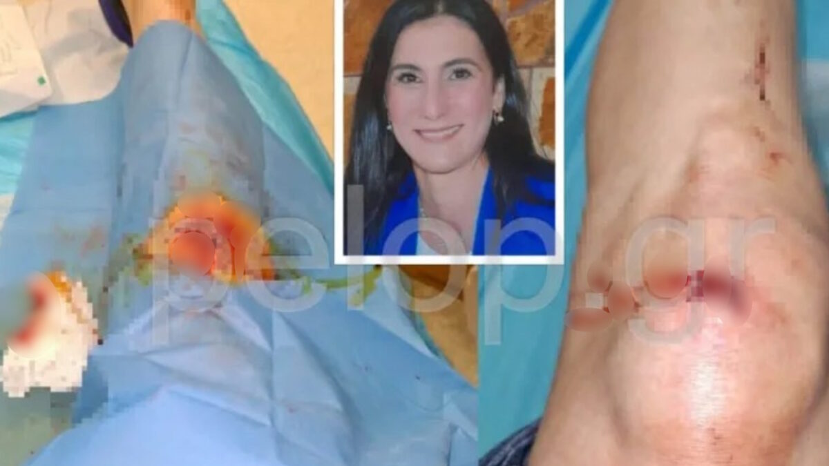 Γεμάτο τραύματα τα πόδια της μητέρας από την σοκαριστική επίθεση