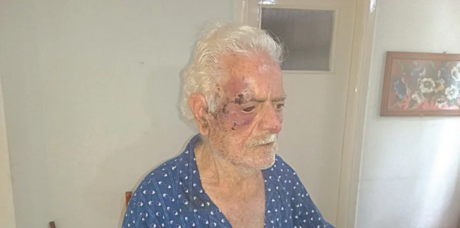 Ο 92χρονος