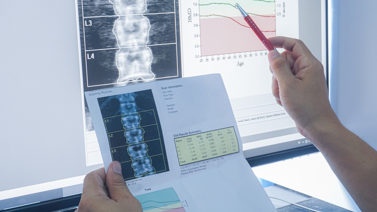 Πηγή φωτό: iStock