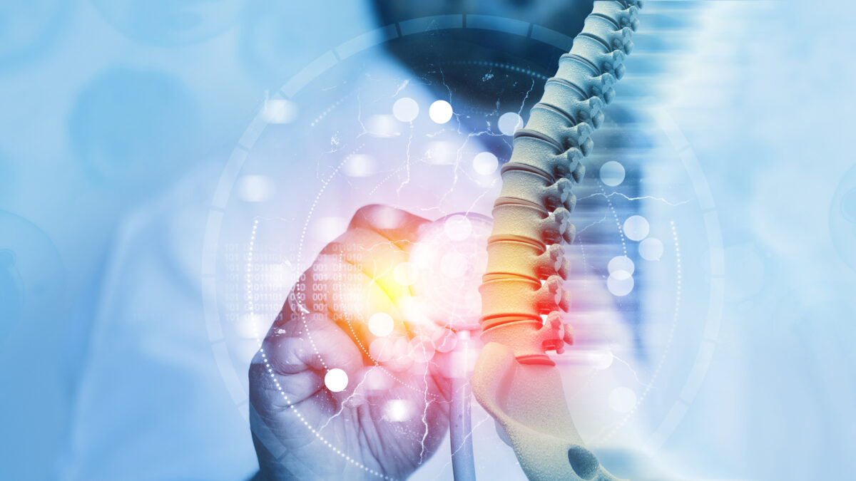 Doctor check and diagnose the human spine on blurred background