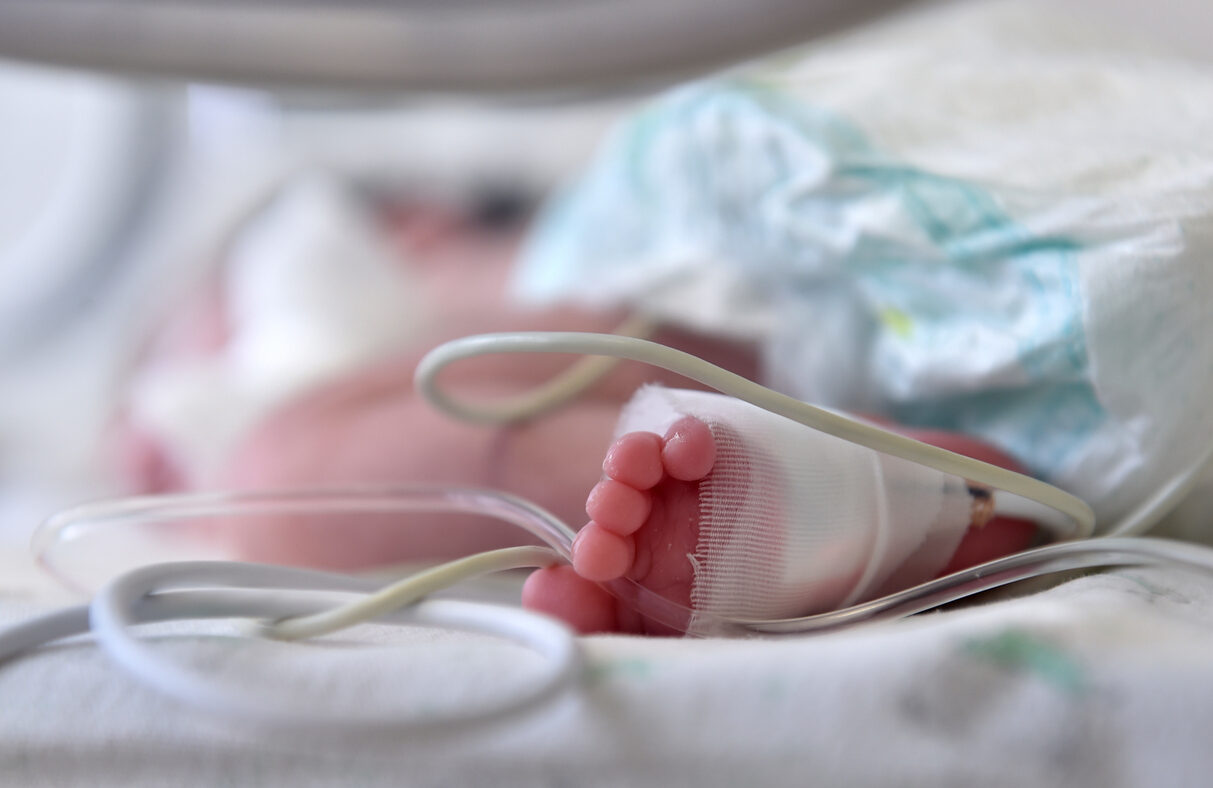 Newborn baby with cannula in the feet on a hospital bed
