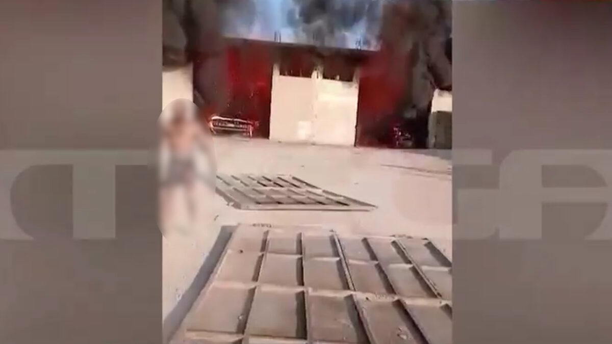 Ο εγκαυματίας εργαζόμενος