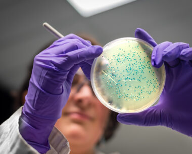 Bacterial culture plate examination by a female researcher in microbiology laboratory
